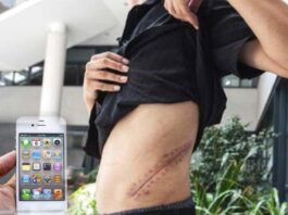 chinese-man-sold-his-kidney-to-buy-iphone